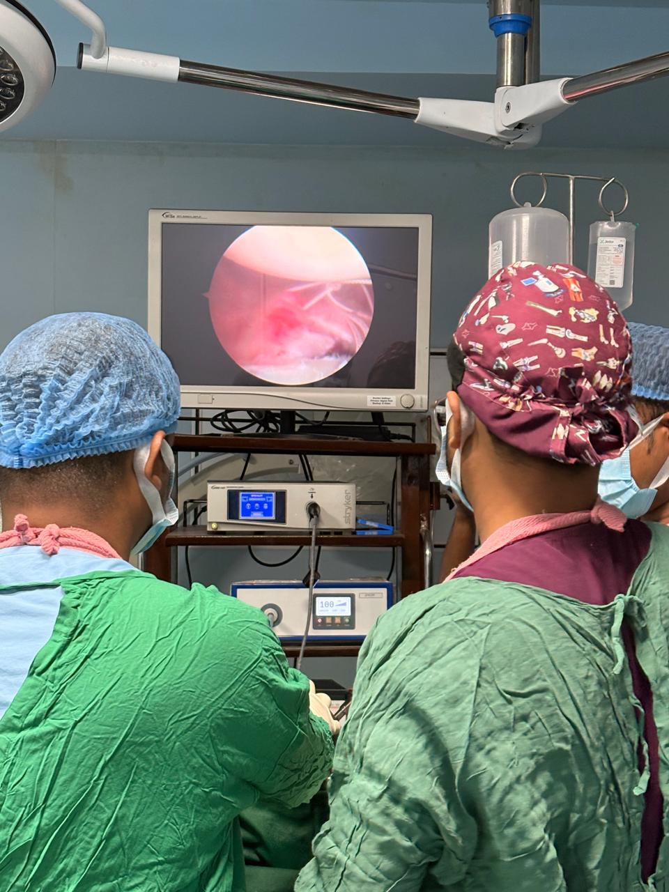 Arthroscopic camera view during minimally invasive knee surgery
